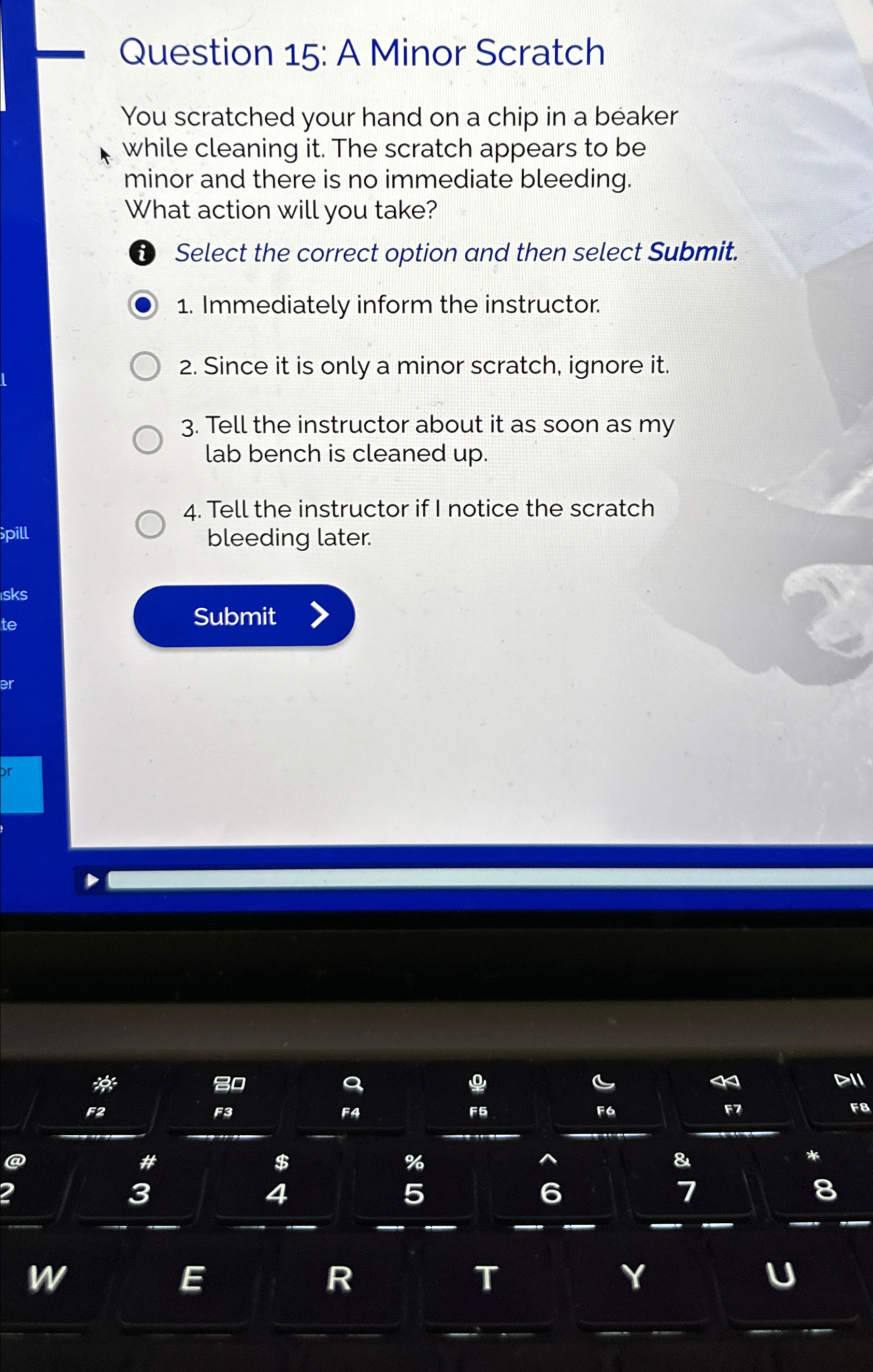  Question 15: A Minor Scratch You scratched your hand on a