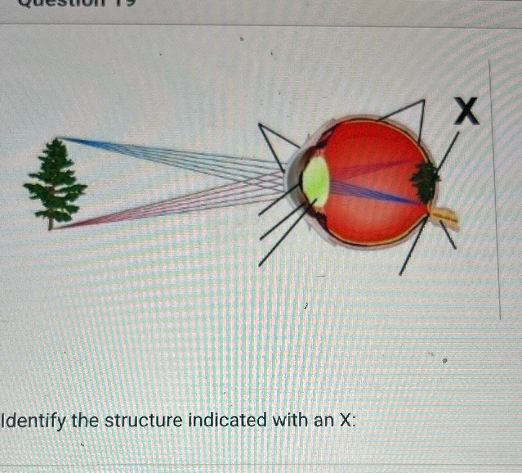  Identify the structure indicated with an X: 