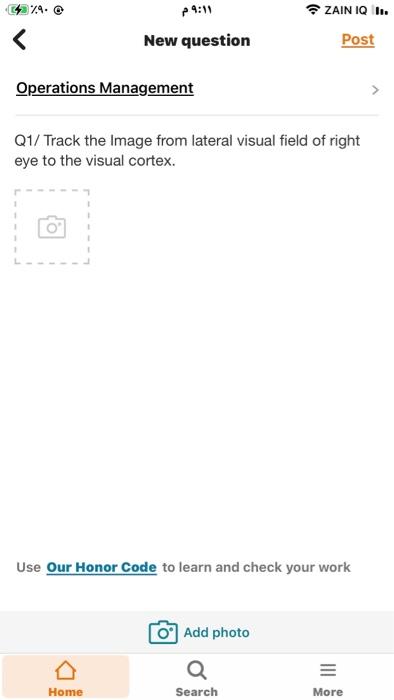 Q1/ Track the Image from lateral visual field of