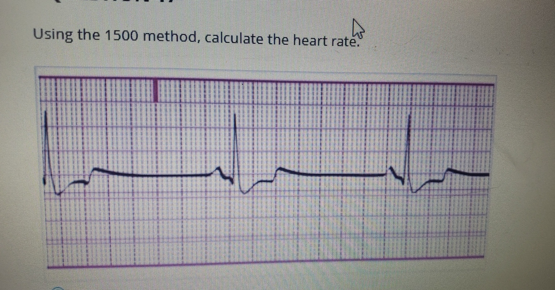 Using the 1 5 0 0 method, calculate the heart