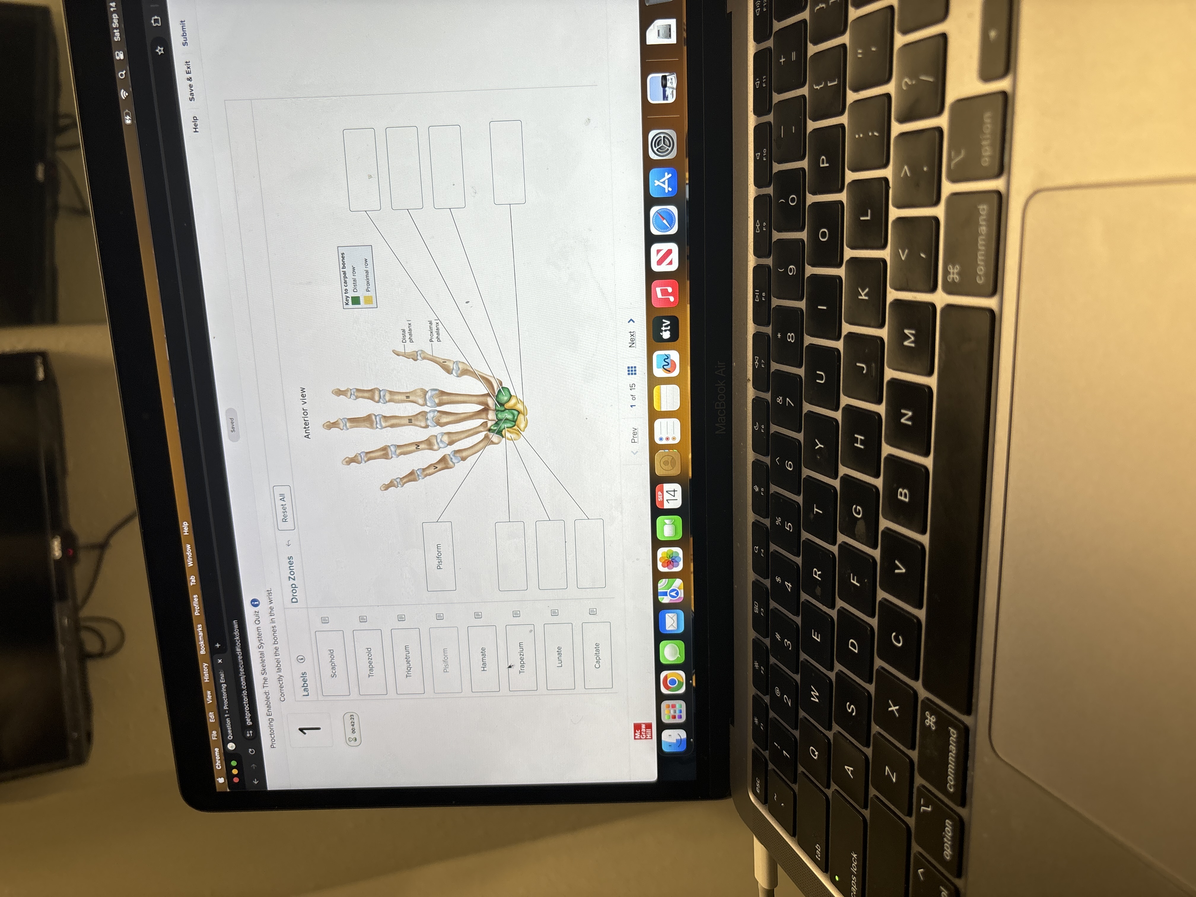 Proctoring Enabled: The Skeletal System Quiz ( i