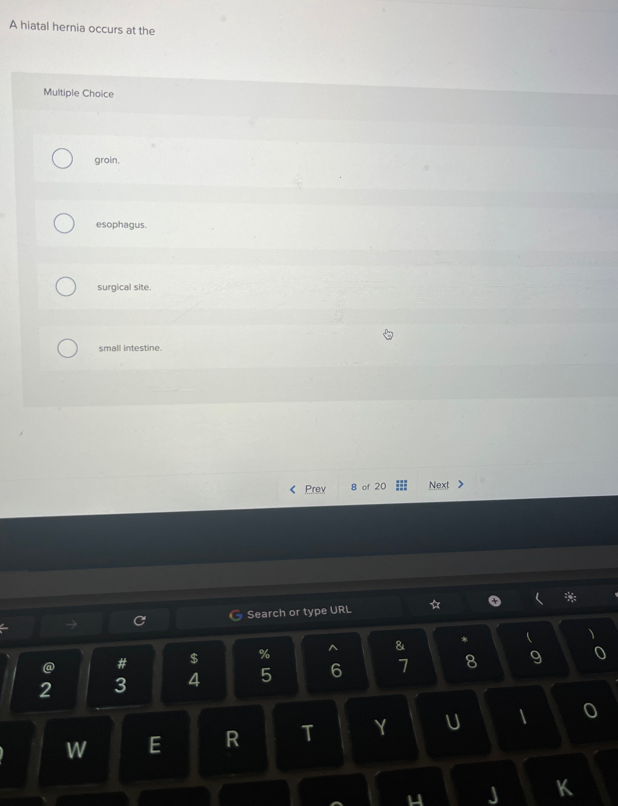 A hiatal hernia occurs at the Multiple Choice
