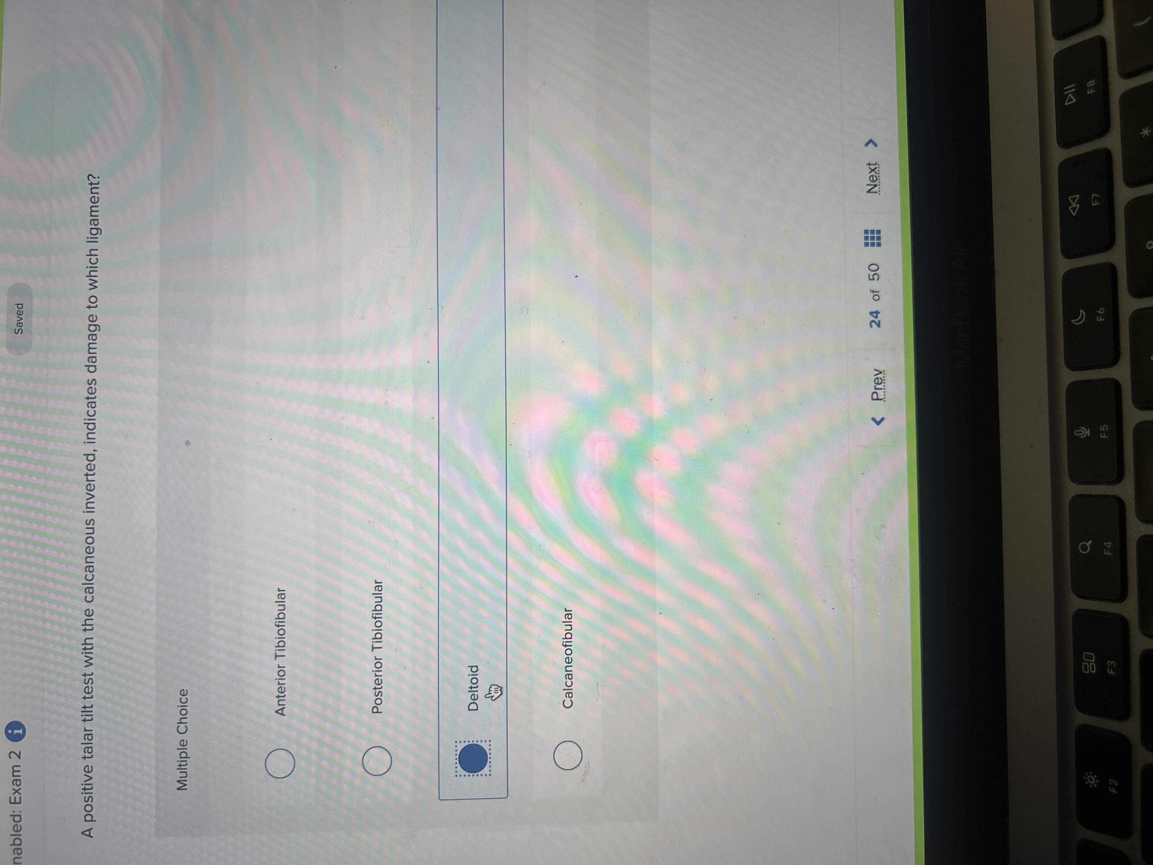 A positive talar tilt test with the calcaneous