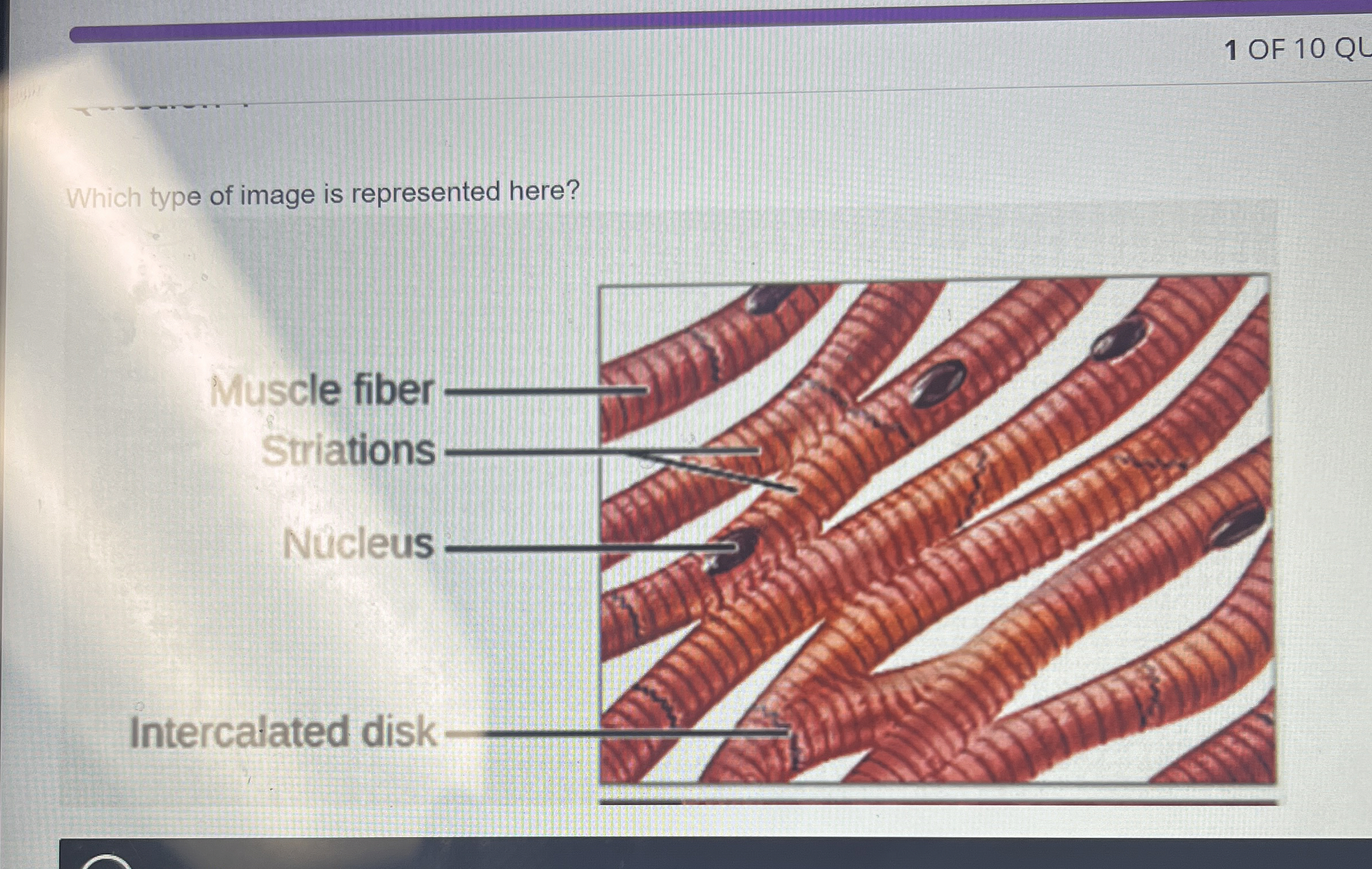 1 OF 1 0 Which type of image is represented here?