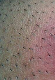 In this class project, you will develop a method