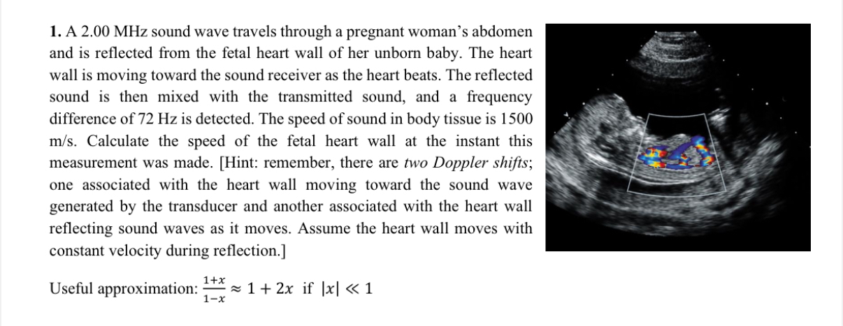 A 2 . 0 0 MHz sound wave travels through a