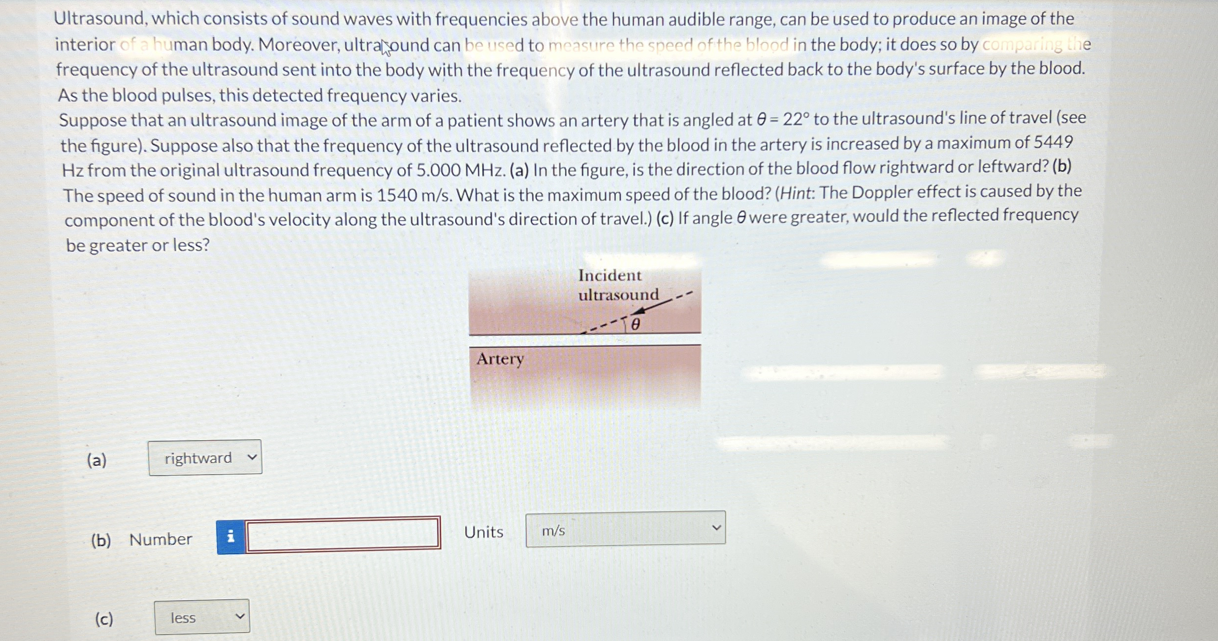 Ultrasound, which consists of sound waves with