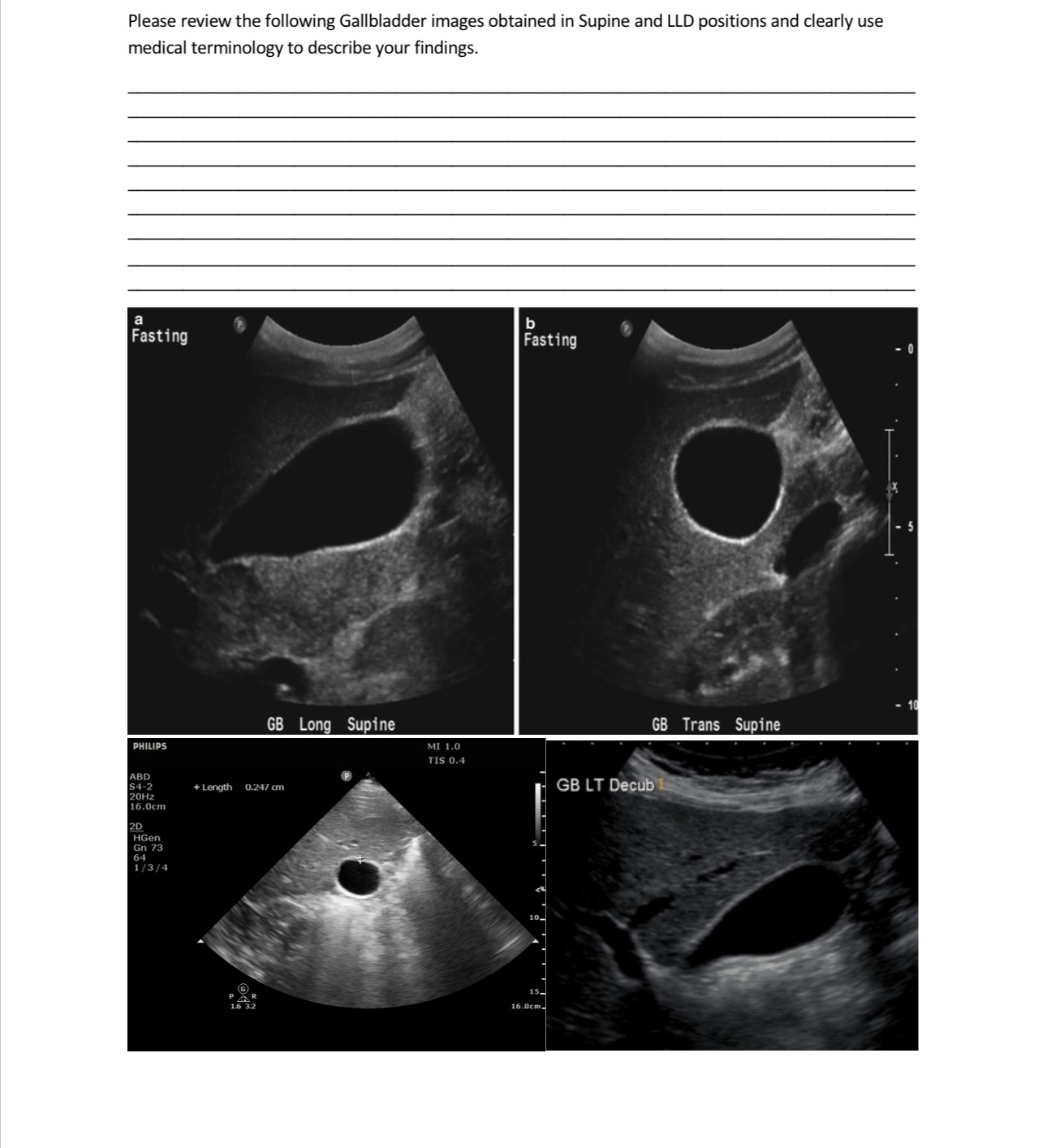 Please review the following Gallbladder images