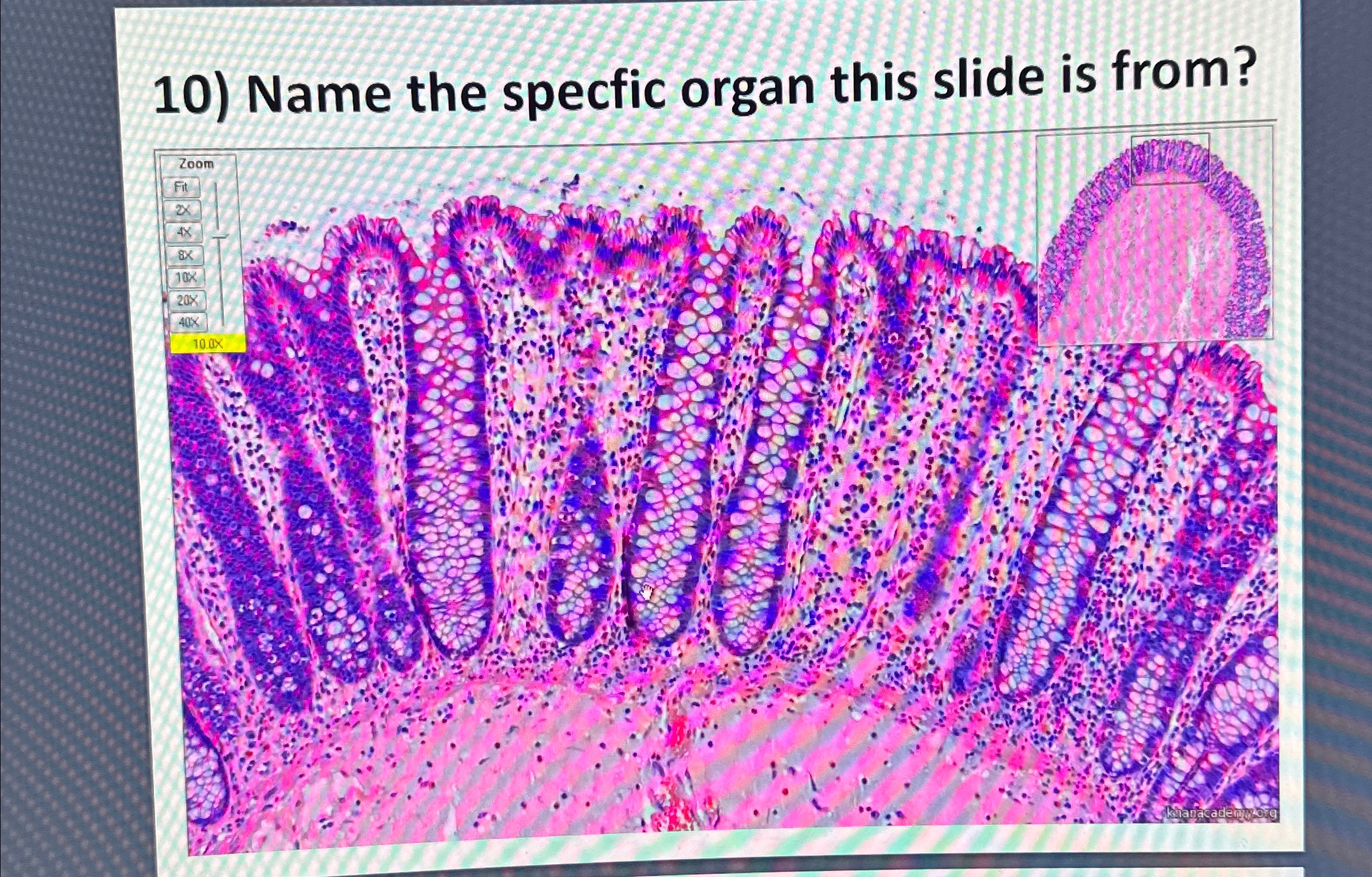 Name the specfic organ this slide is from? answer