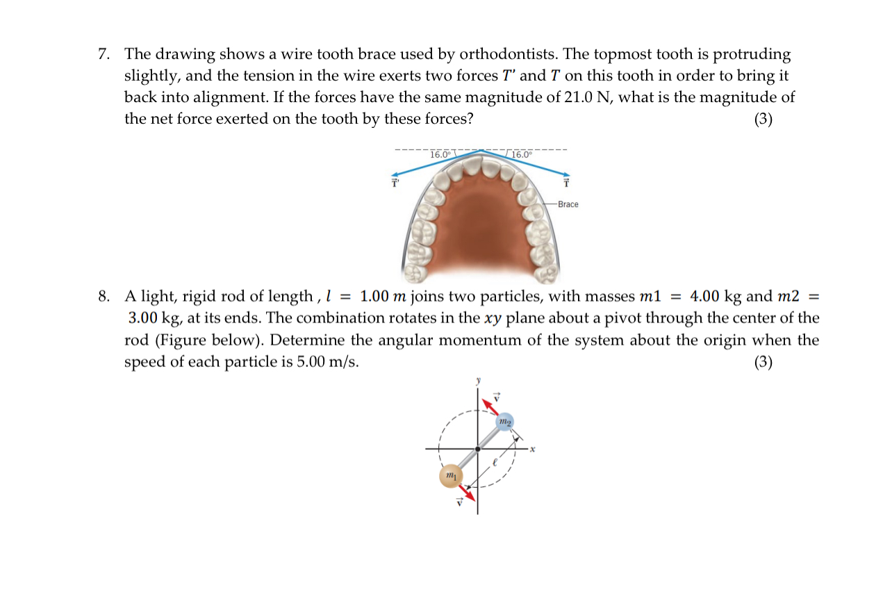The drawing shows a wire tooth brace used by