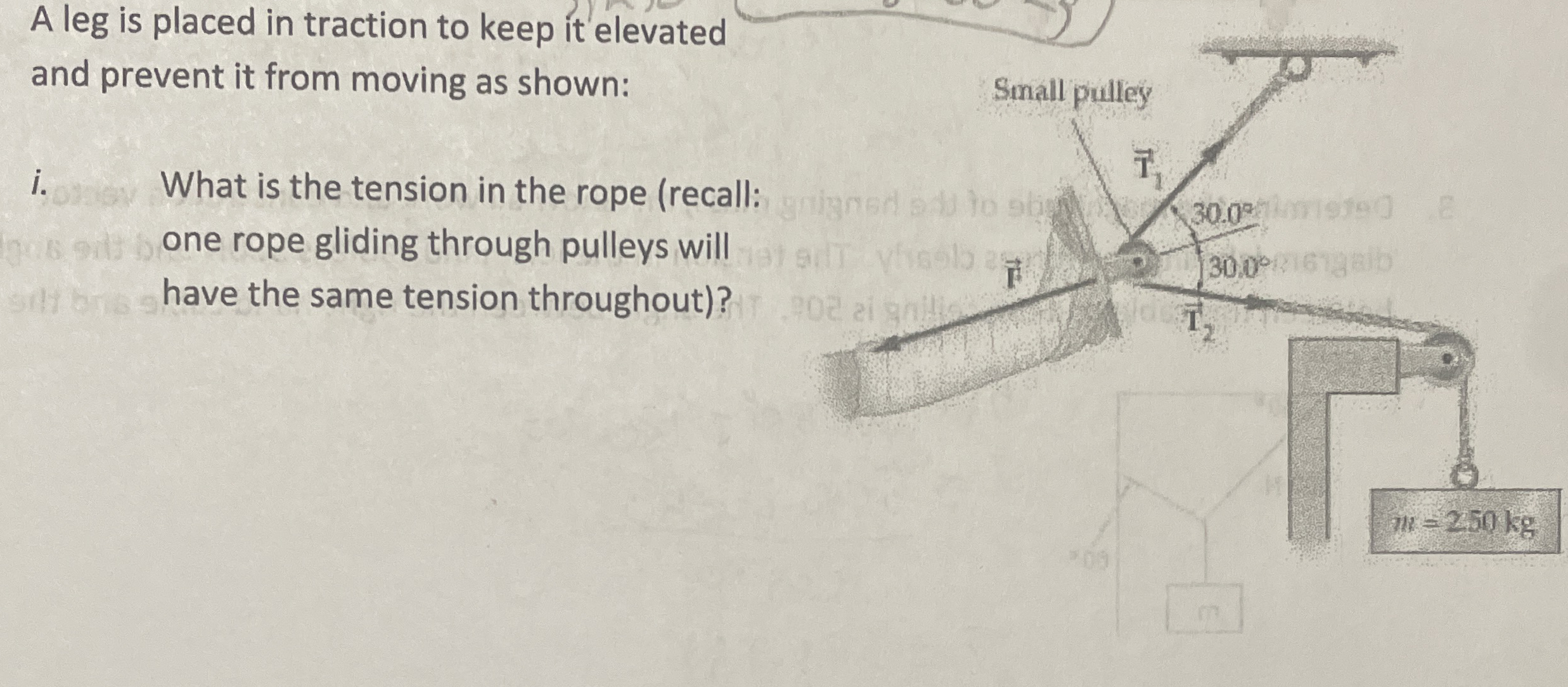 A leg is placed in traction to keep it elevated
