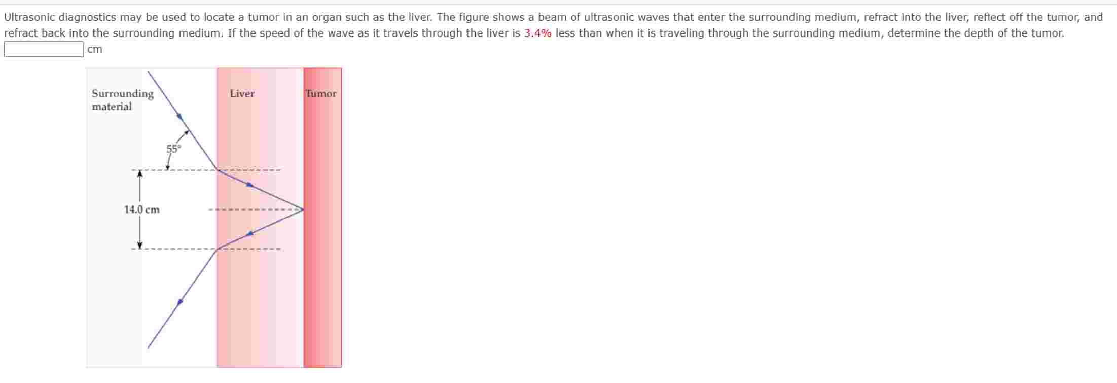 Ultrasonic diagnostics may be used to locate a