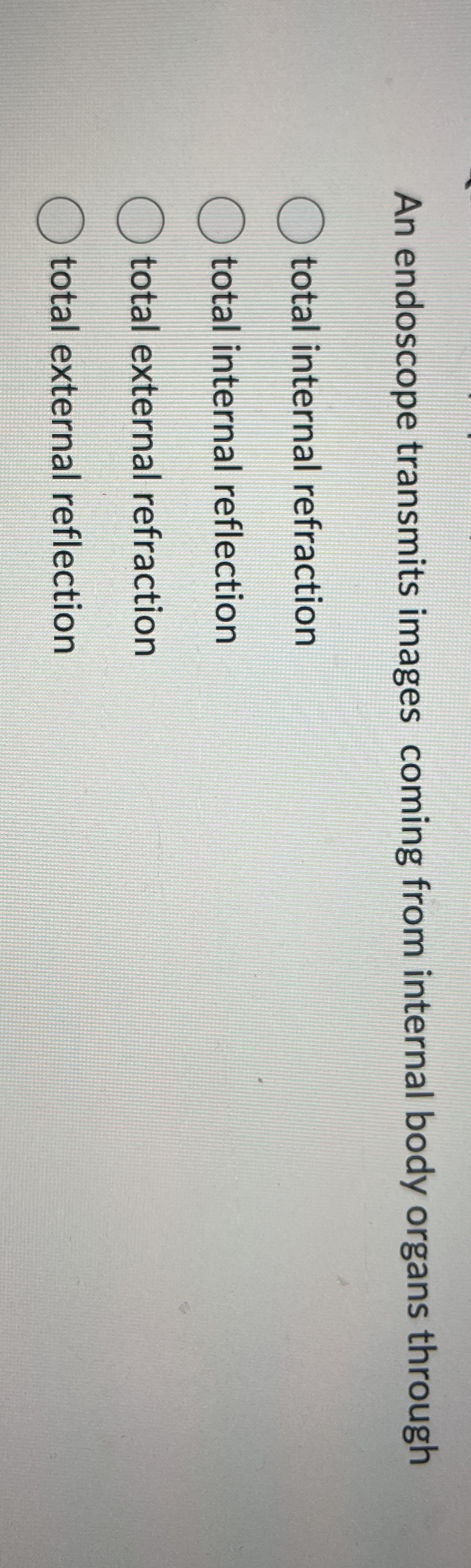 An endoscope transmits images coming from