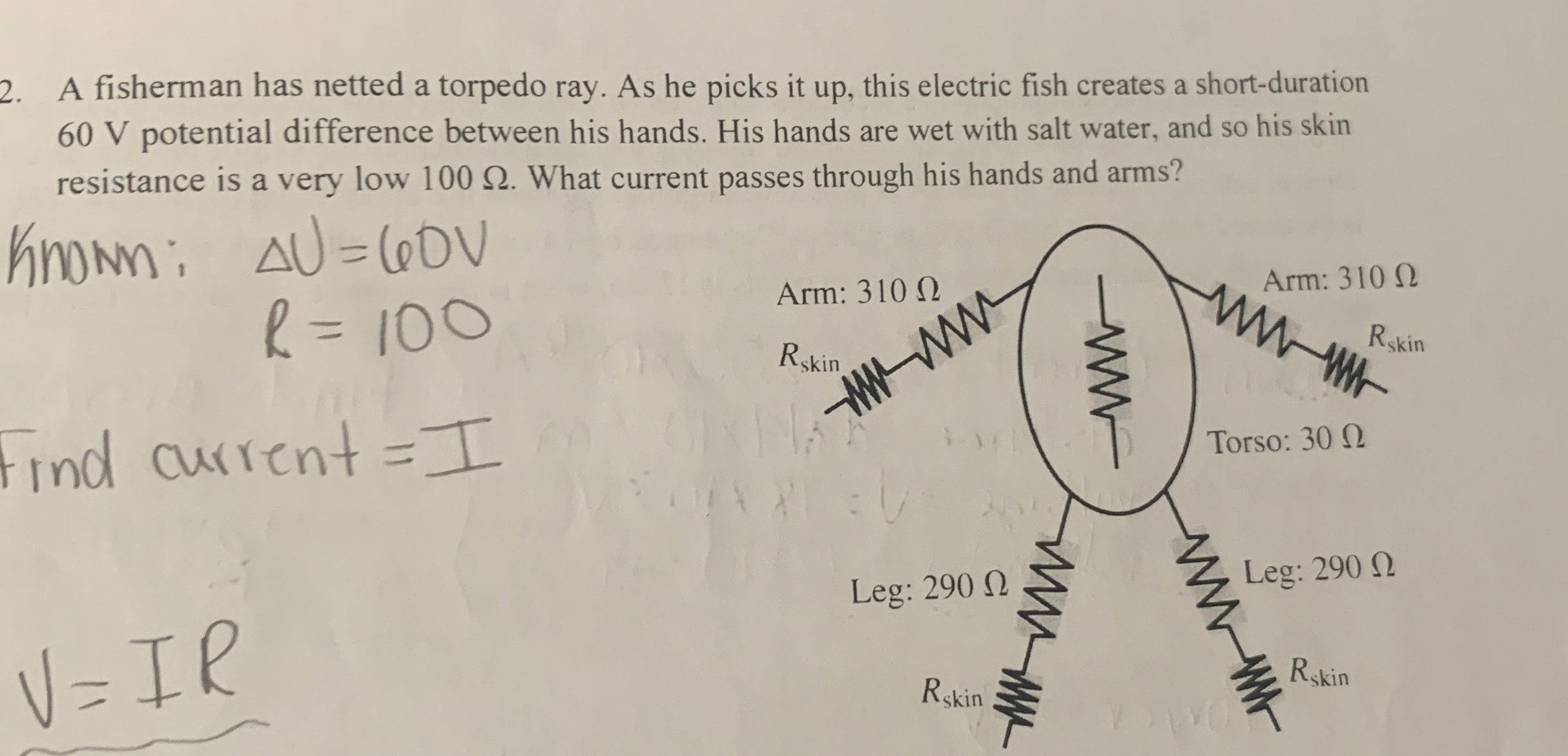 A fisherman has netted a torpedo ray. As he picks