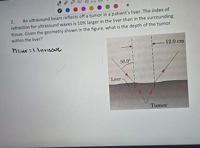 An ultrasound beam reflects off a tumor in a