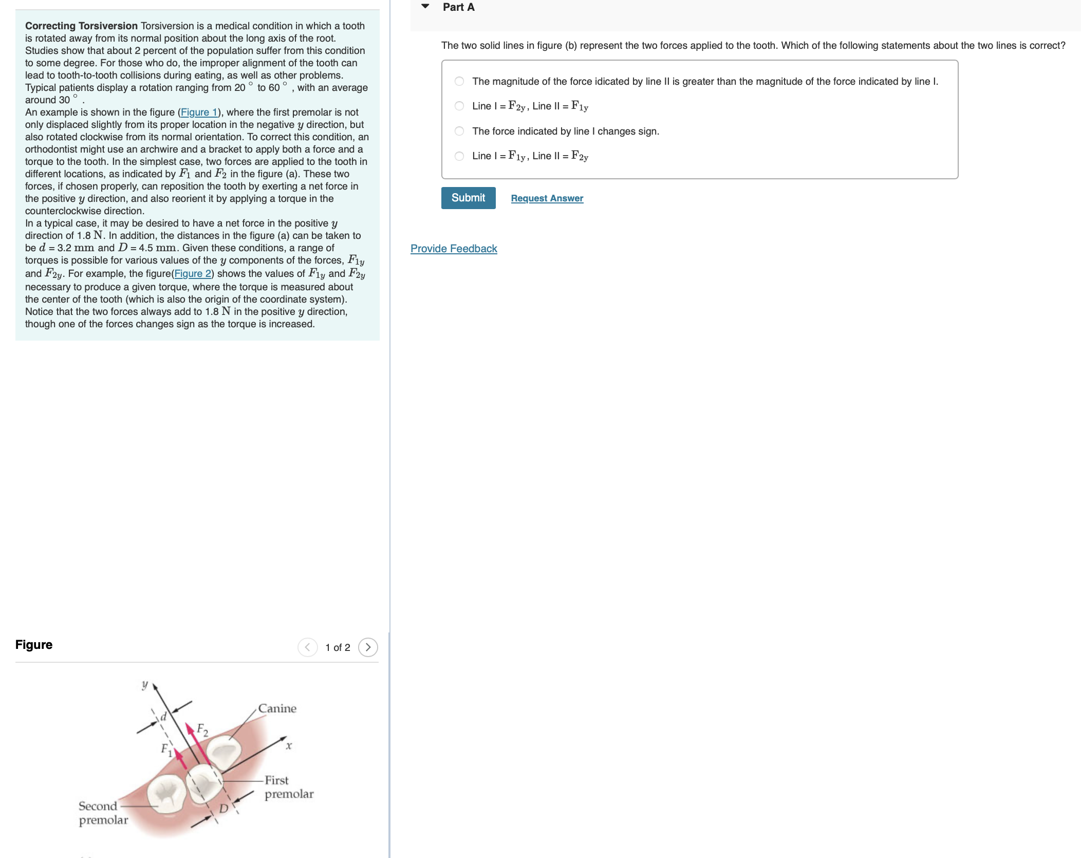 Correcting Torsiversion Torsiversion is a medical