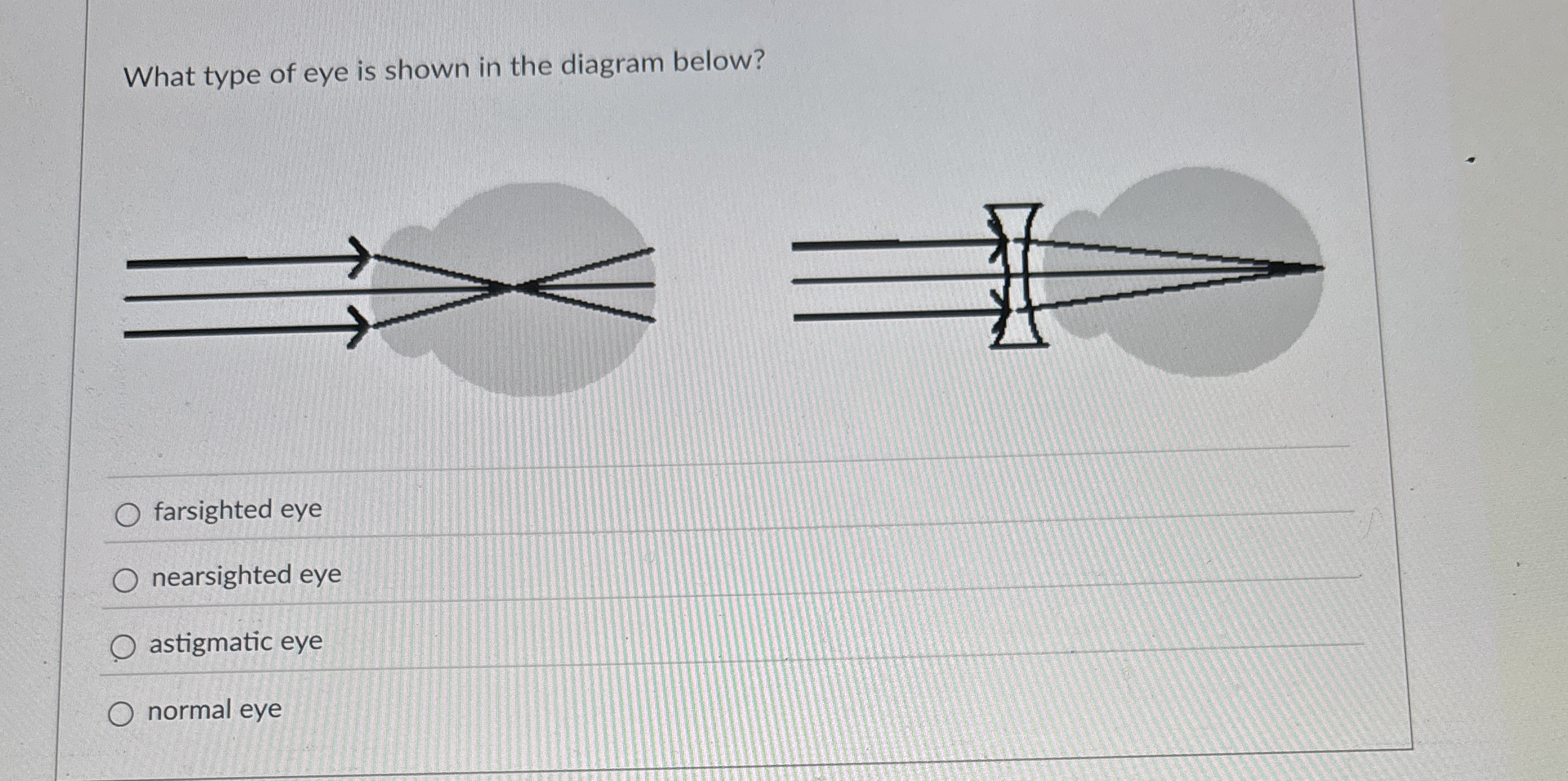 What type of eye is shown in the diagram below?