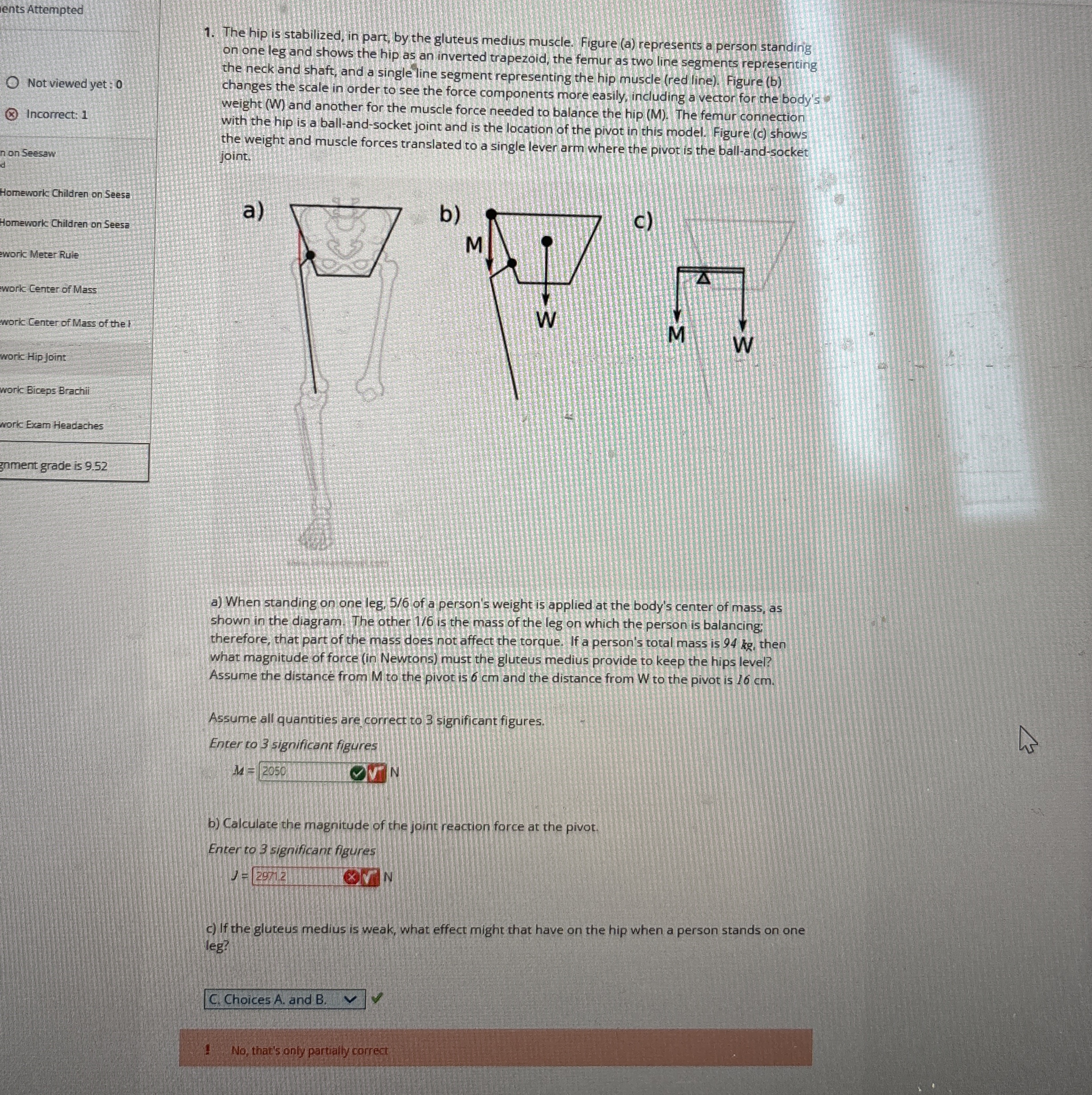 ents Attempted Not viewed yet: 0 The hip is