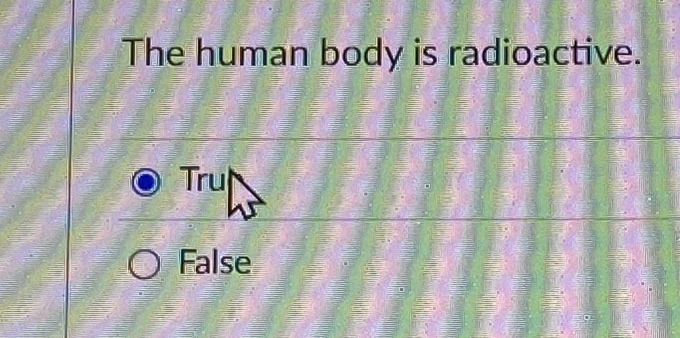 The human body is radioactive. TruE False