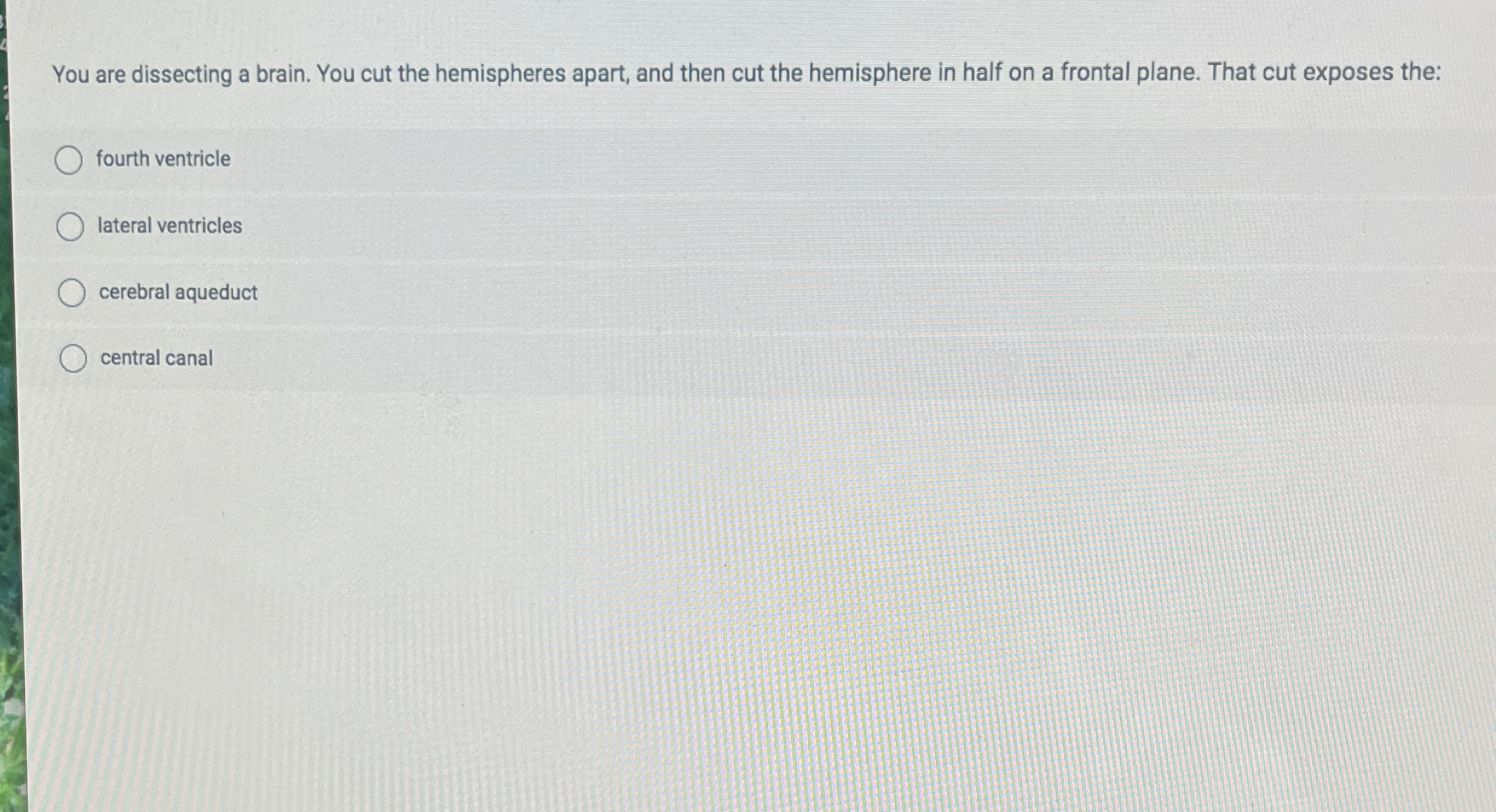 You are dissecting a brain. You cut the