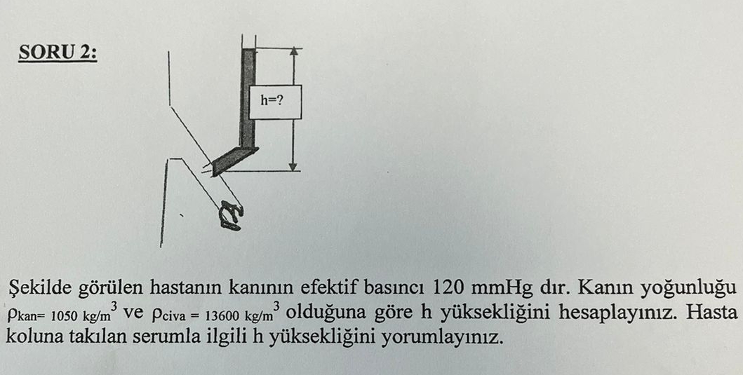 SORU 2 : ekilde g r len hastan n kan n n efektif