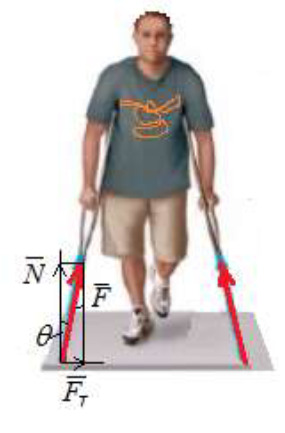 A patient leans on crutches against the floor