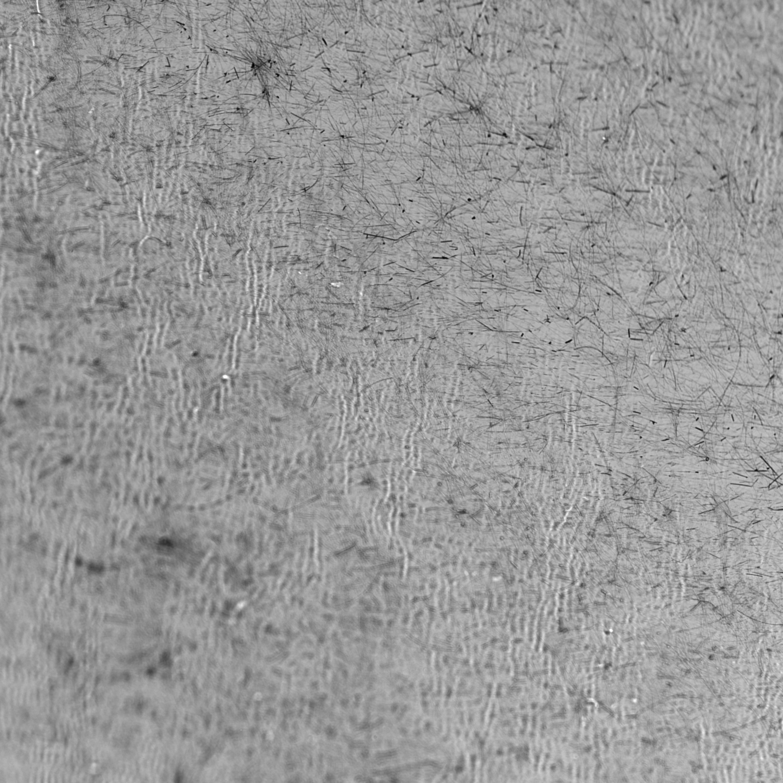 [ Image Analysis / Image processing ] Please