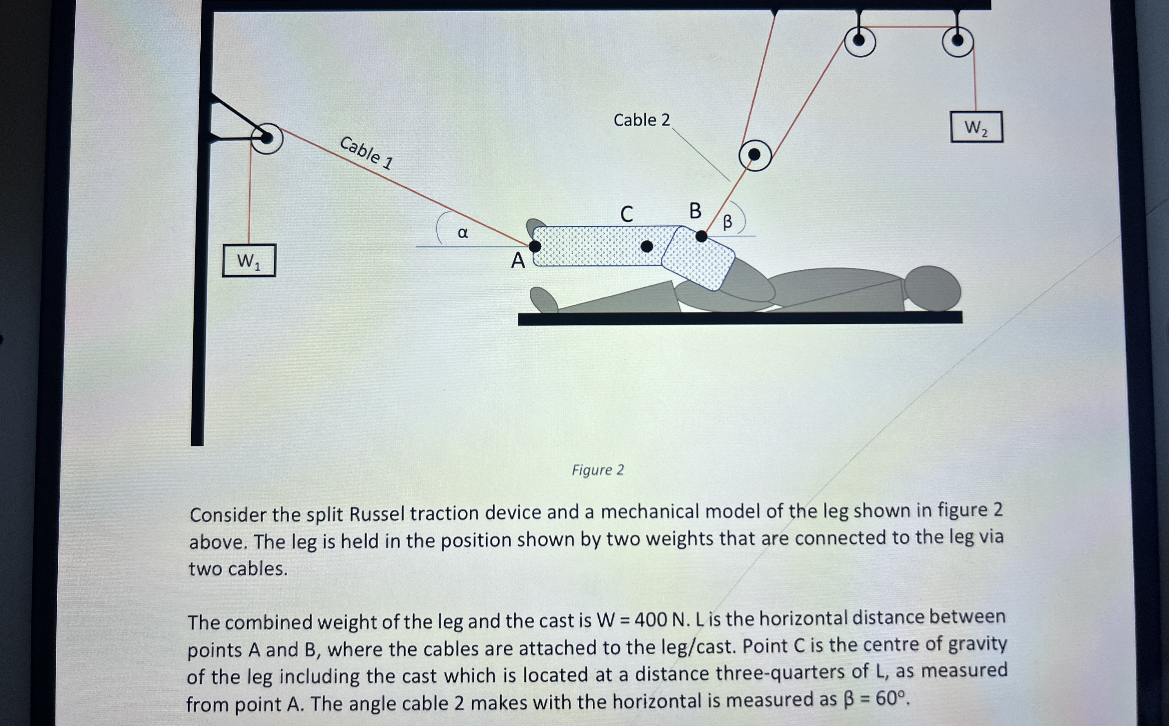 Figure 2 Consider the split Russel traction