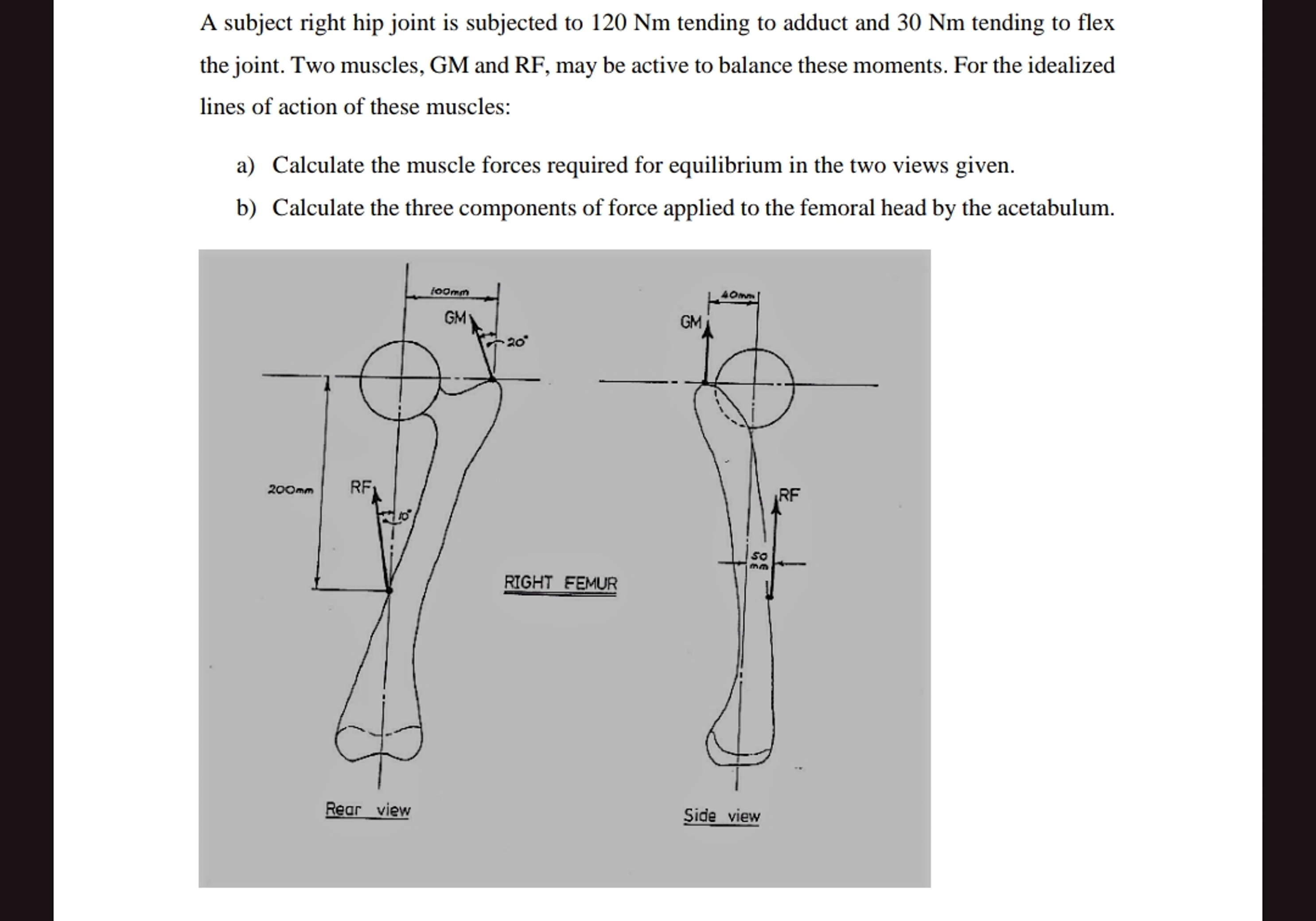 A subject right hip joint is subjected to 1 2 0