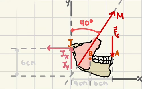 The Free Body Diagram shows forces applied to the