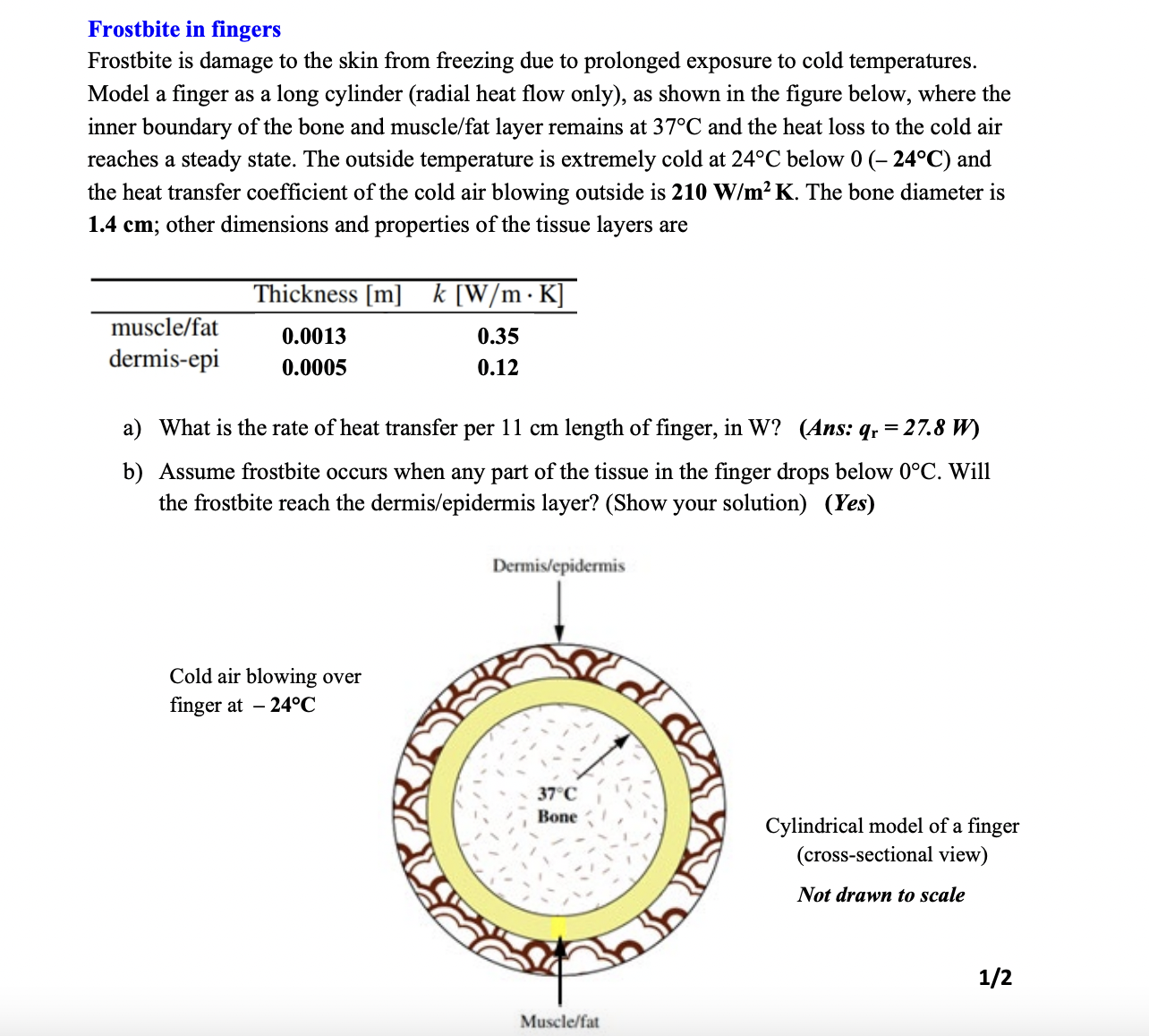 Frostbite in fingers Frostbite is damage to the