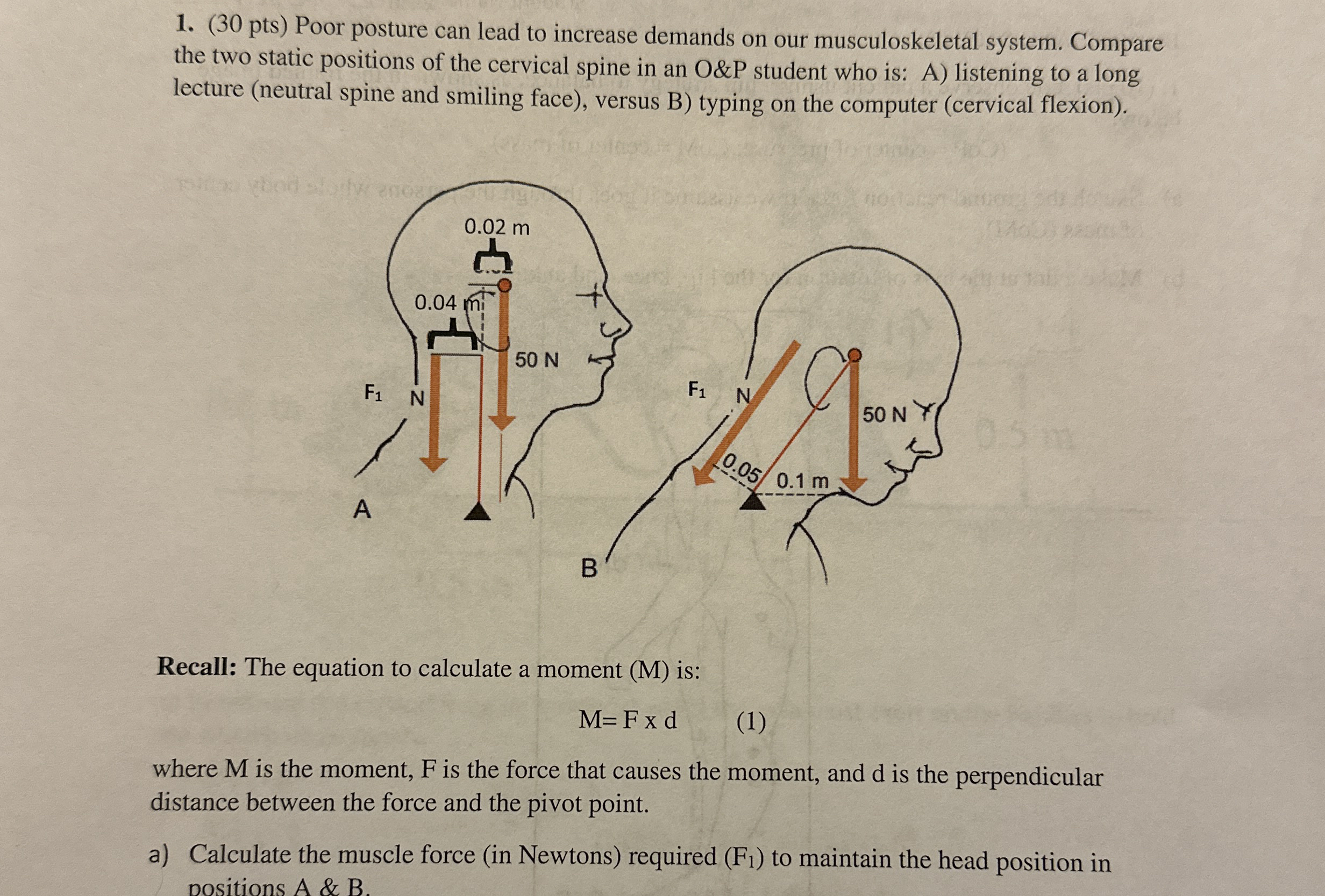( 3 0 pts ) Poor posture can lead to increase