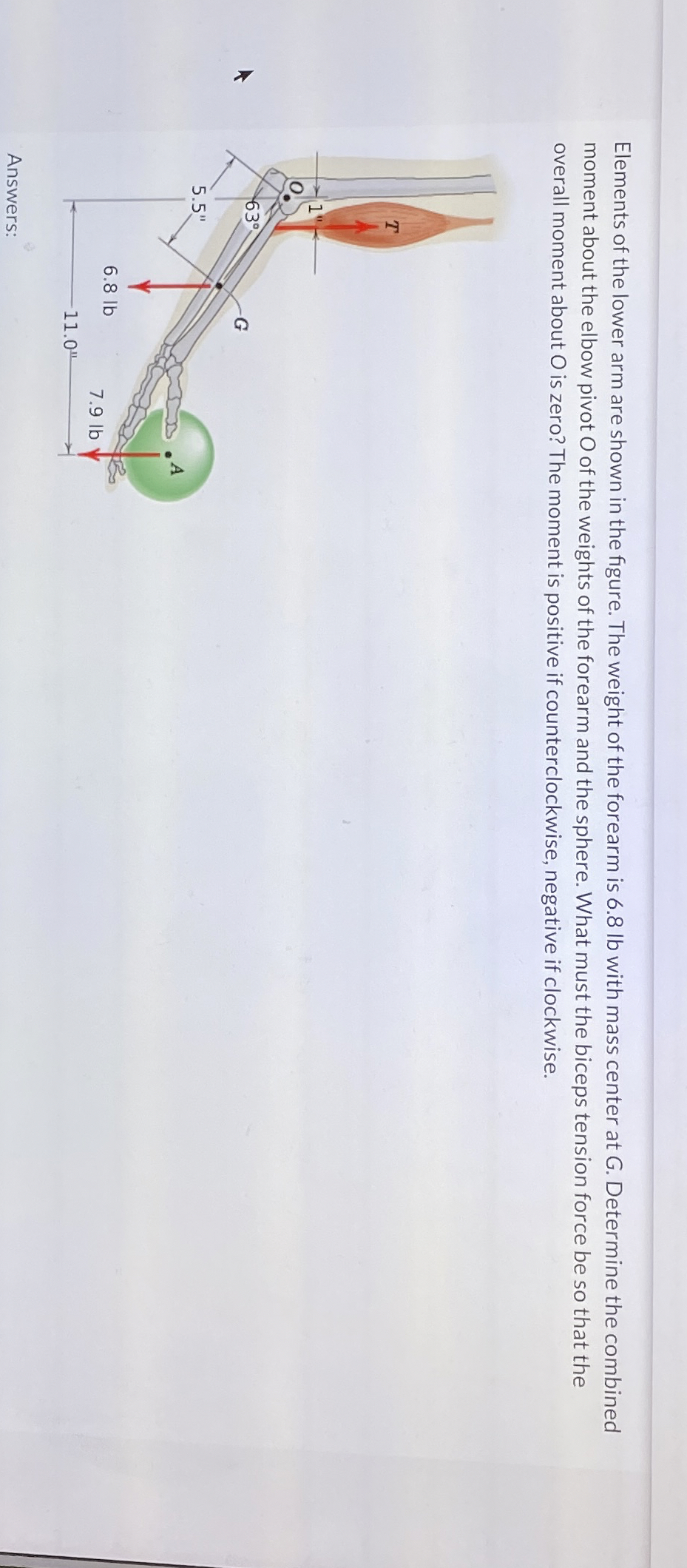 Elements of the lower arm are shown in the