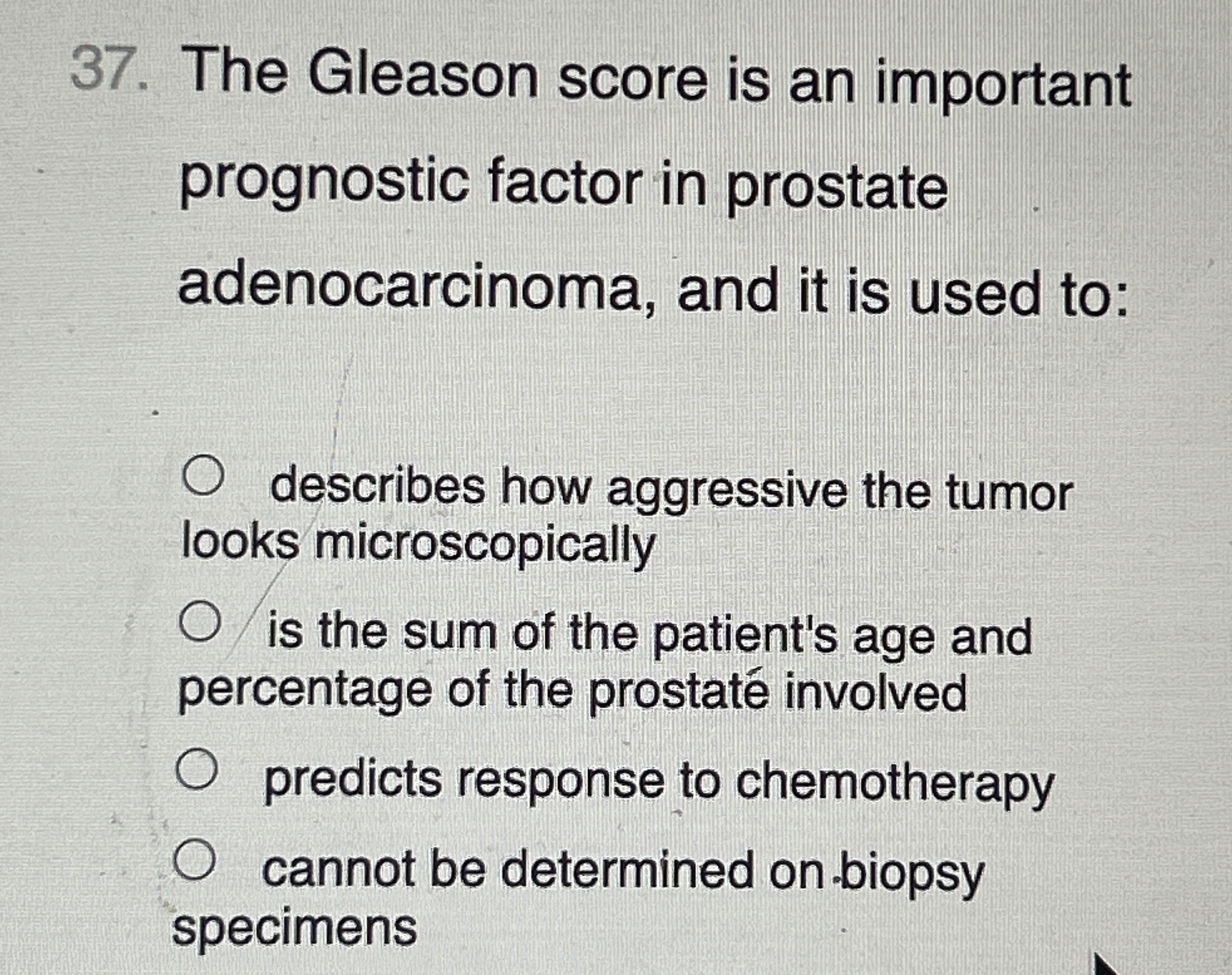 The Gleason score is an important prognostic