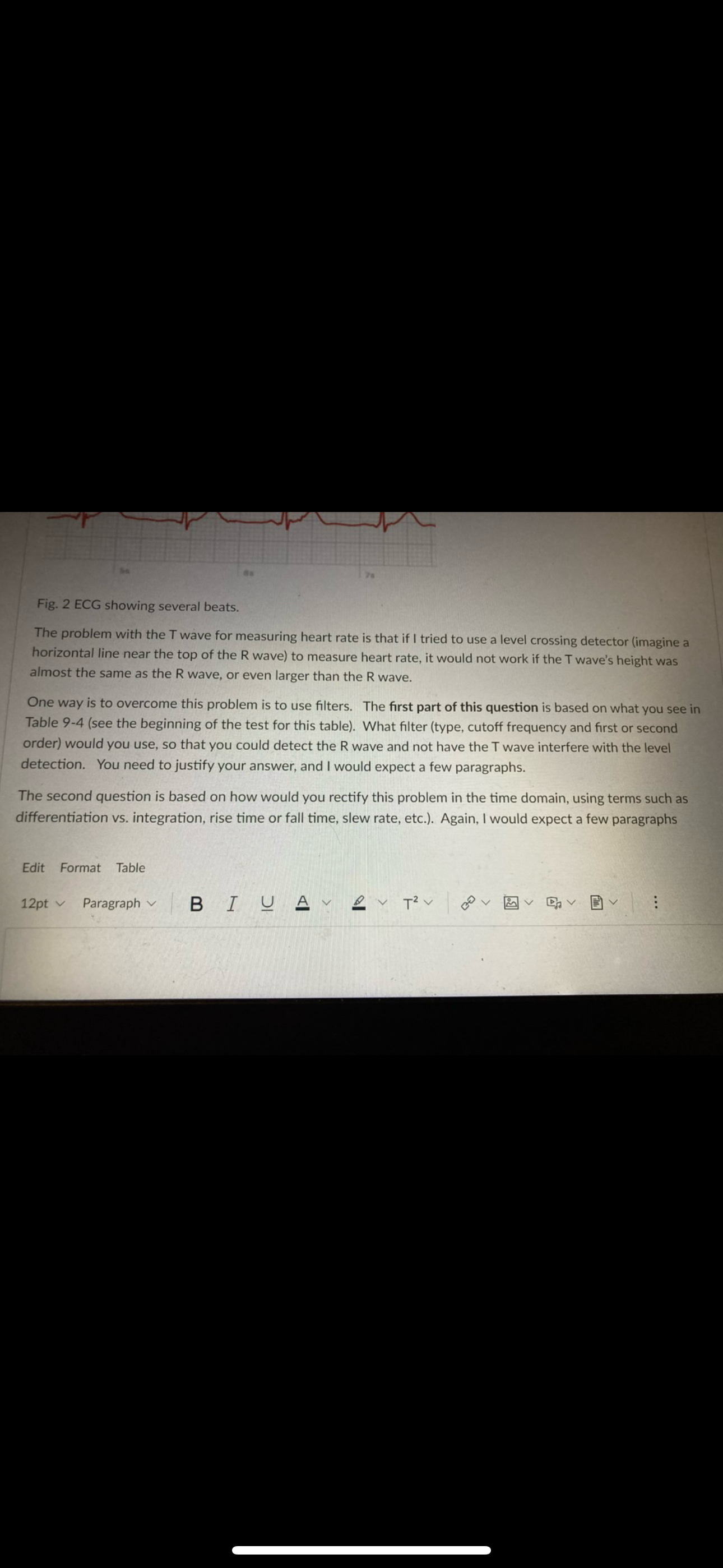 Fig. 2 ECG showing several beats. The problem