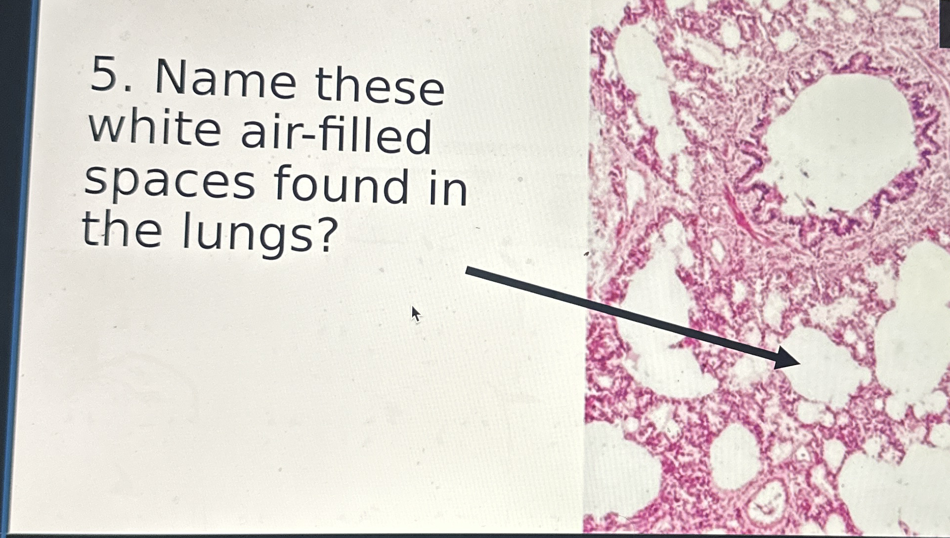 Name these white air - filled spaces found in the