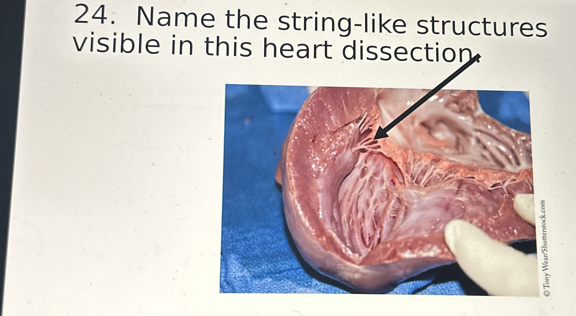 Name the string - like structures visible in this