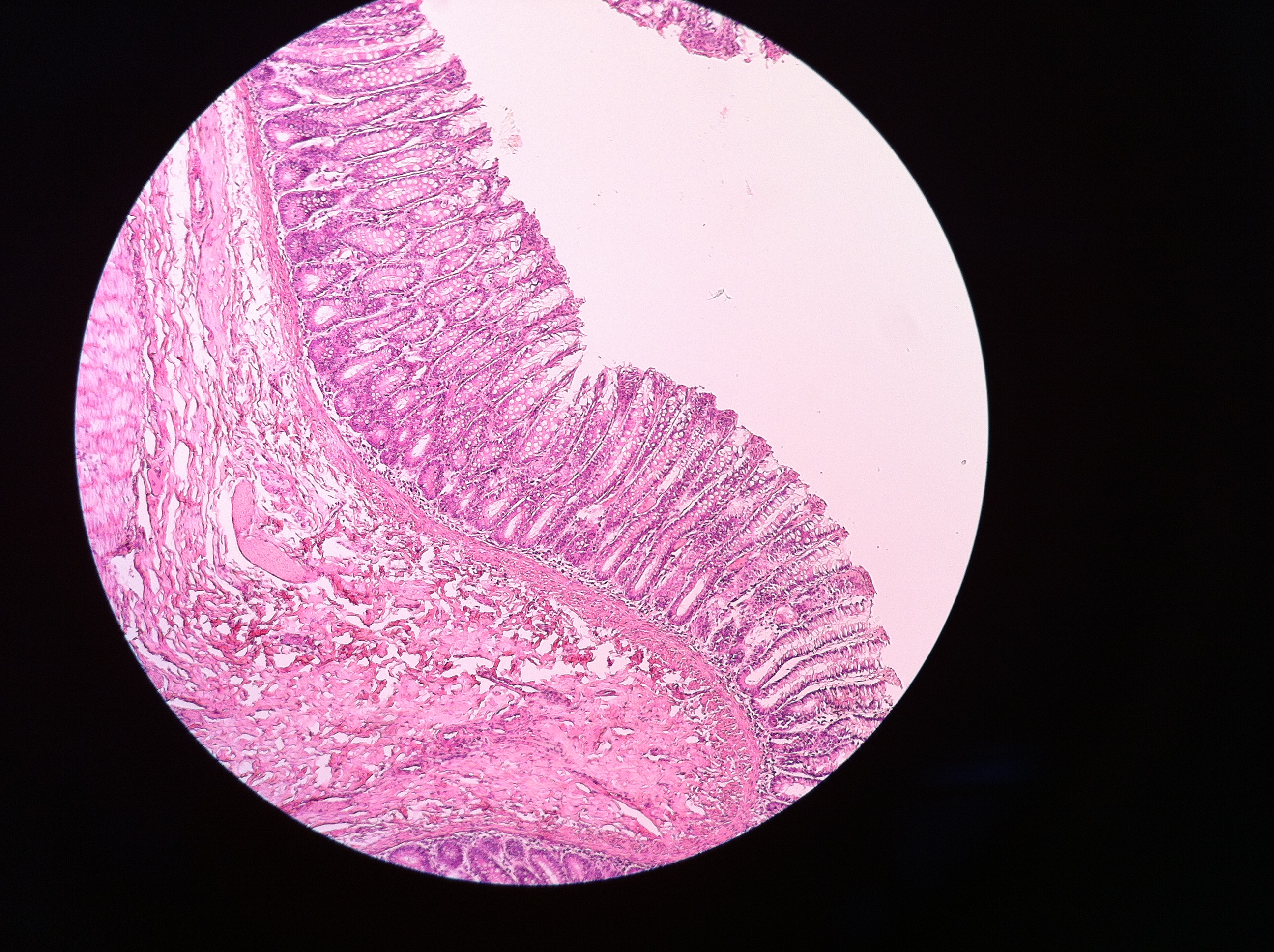 BRIEFLY describe one way in which the structure