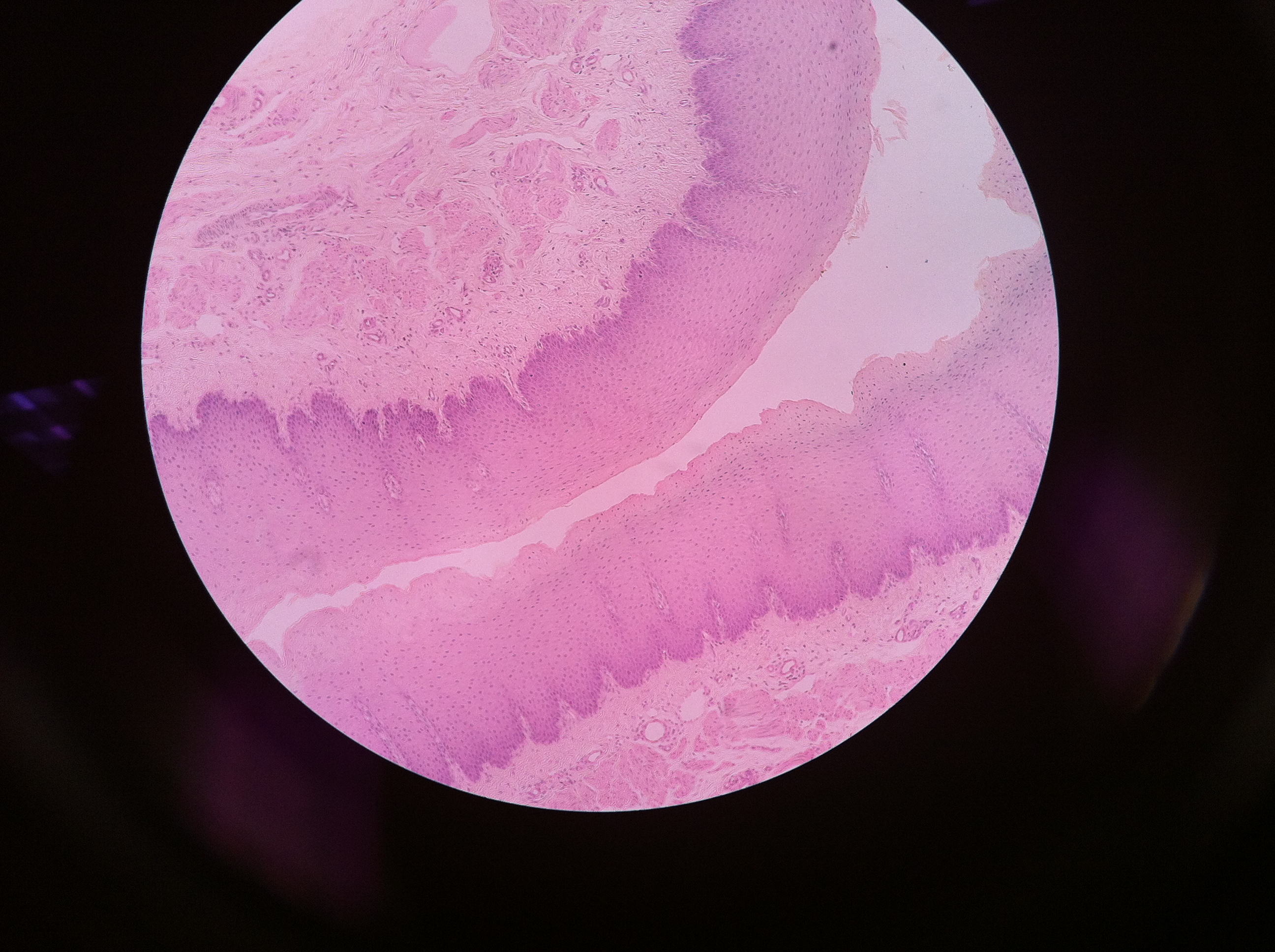 This organ is the esophagusOne of its functions
