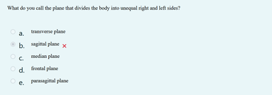 CHECK What do you call the plane that divides the