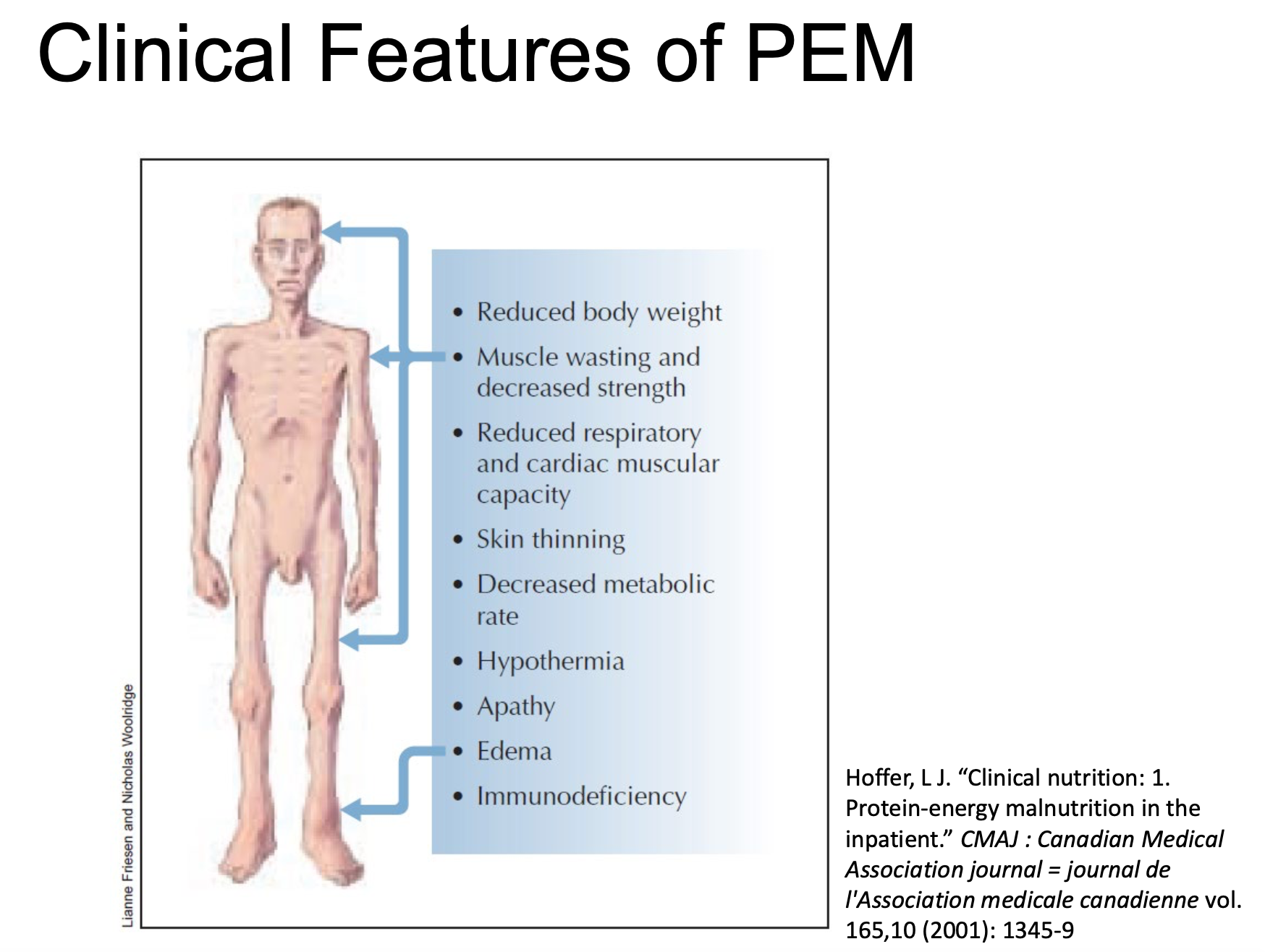 eaplin Clinical Features of PEM . Reduced body