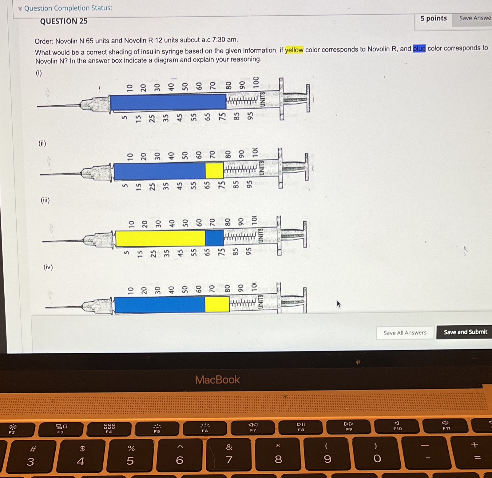 Question Completion Status: QUESTION 25 5 points