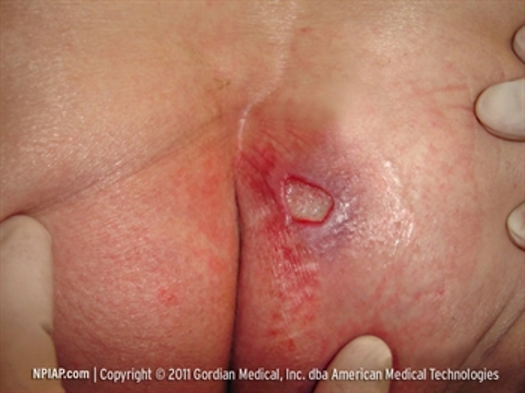 Case Study Information: Mr William Jackson-