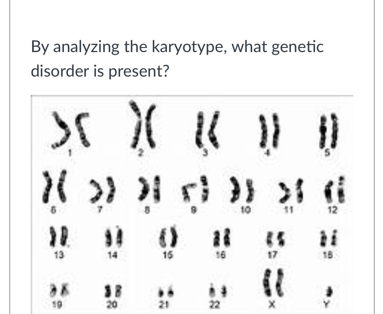 By analyzing the karyotype what genetic disorder