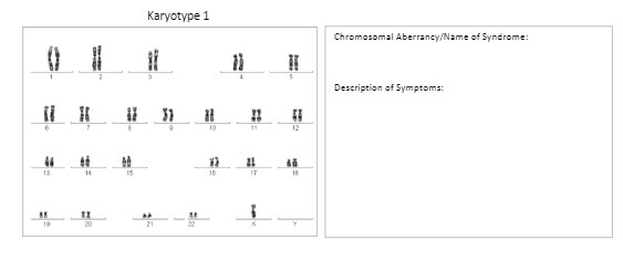 Karyotype 1 Chromosomal Aberrancy/Name of
