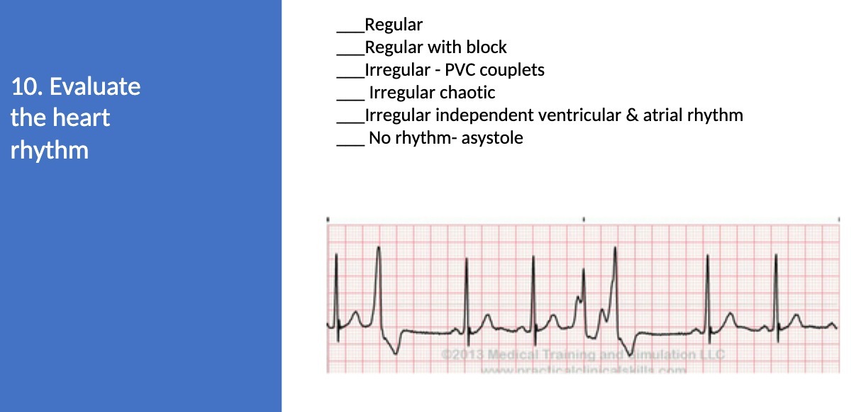 Regular Regular with block Irregular - PVC