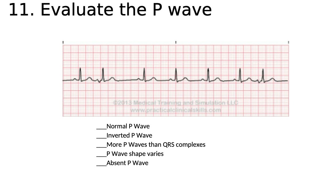 11. Evaluate the P wave 2013 Medical Training and