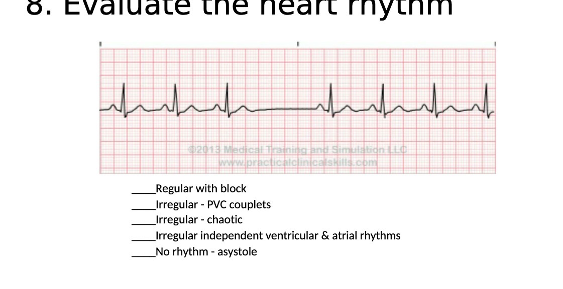 o. Evaluate the heart rhythm 02013 Medical
