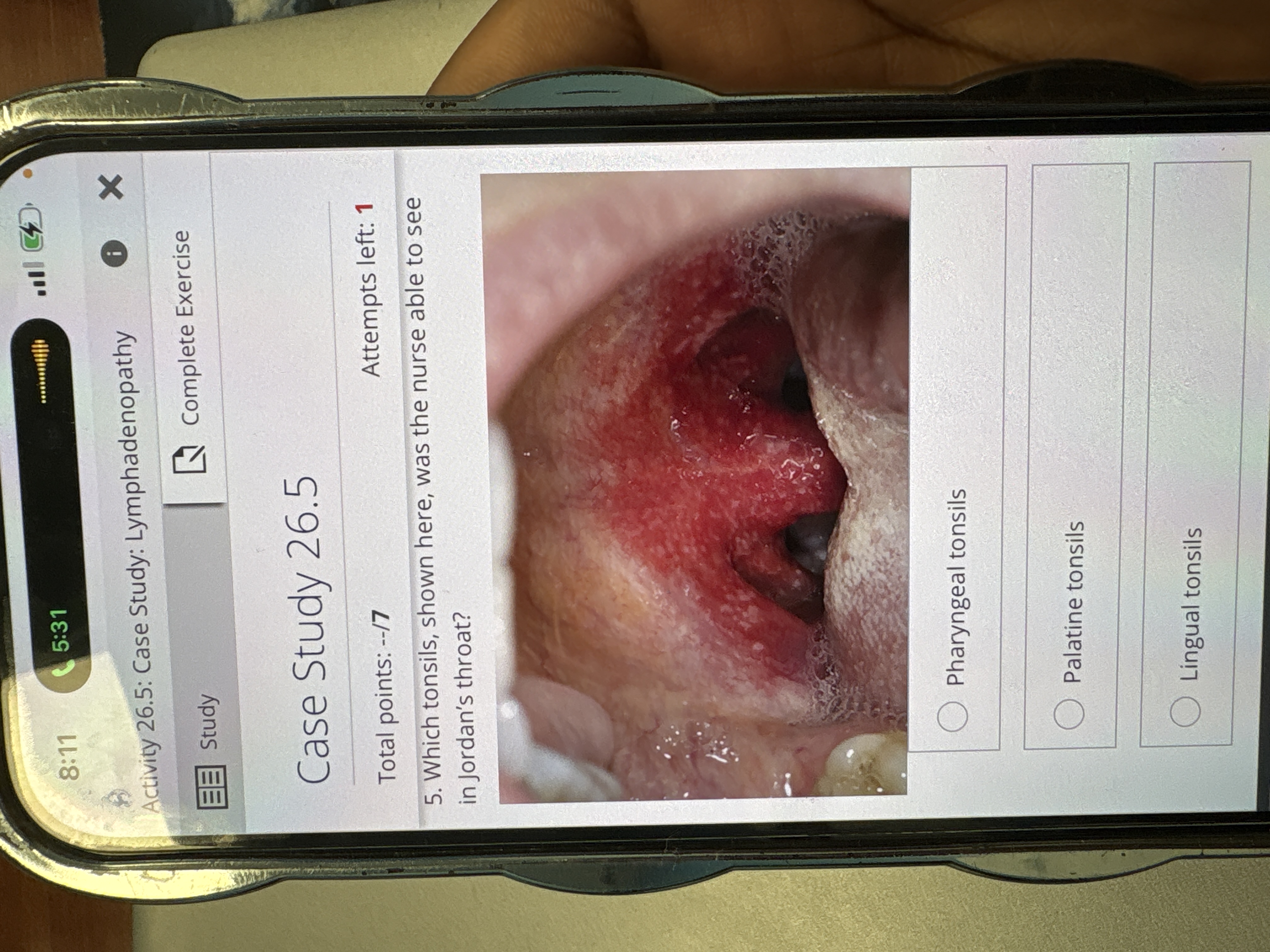 Answer 8:11 5:31 Activity 26.5: Case Study: