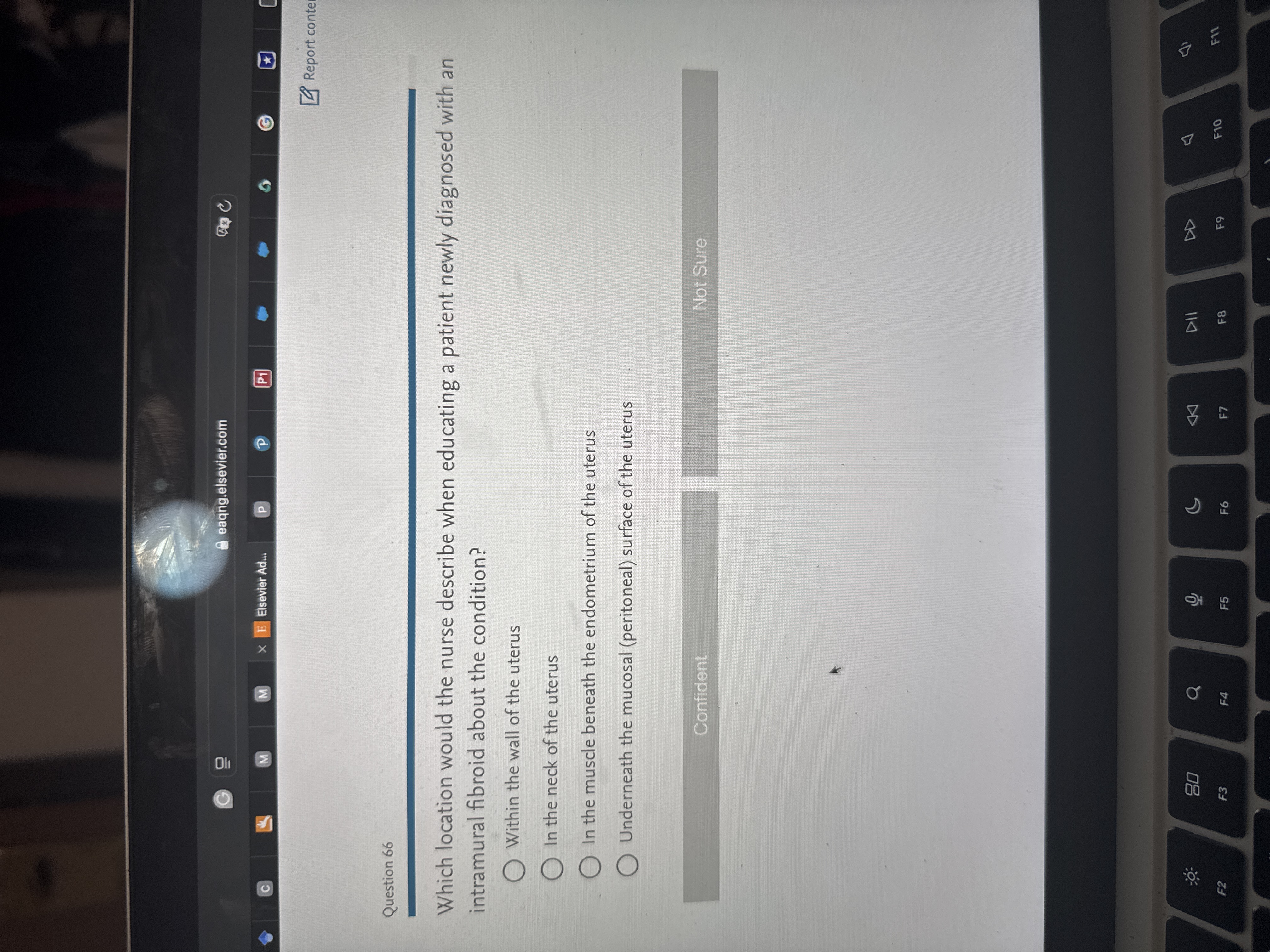 Answer G A eaqng.elsevier.com FO C C M M X E